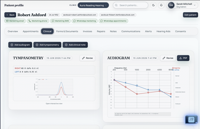 Seviko patient record showing audiogram chart, tympanometry results and clinical tabs